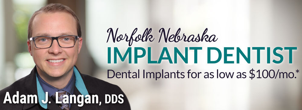 Norfolk Nebraska Dental Implants for as low as 1xx/mo.