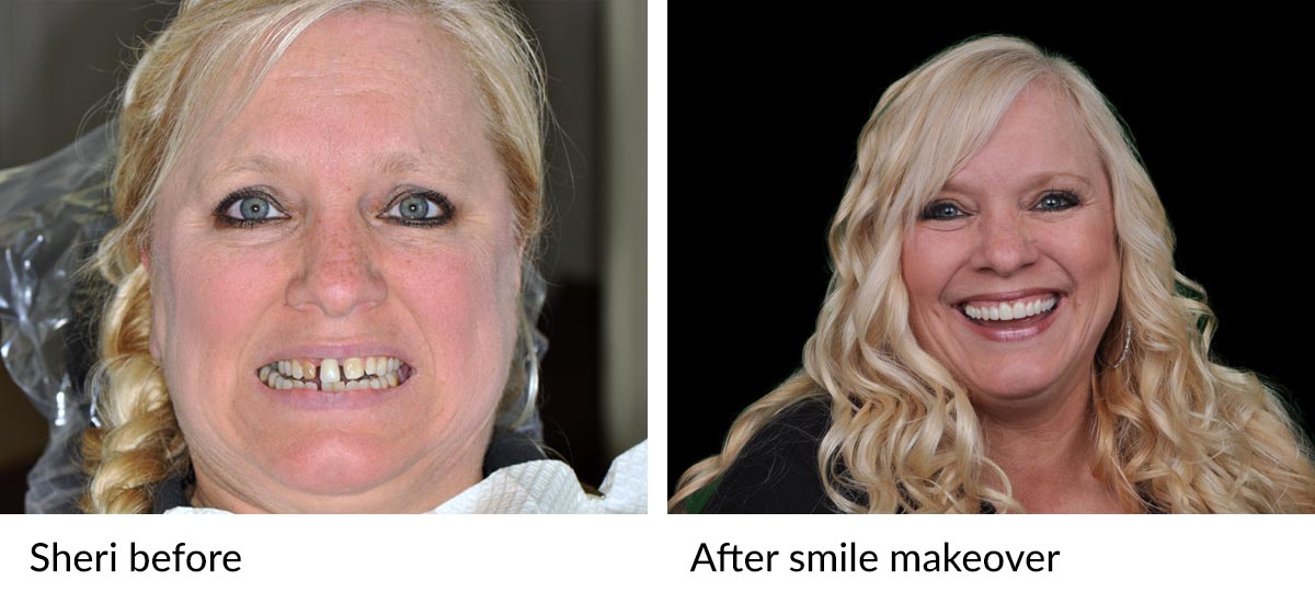 Sheri's before and after